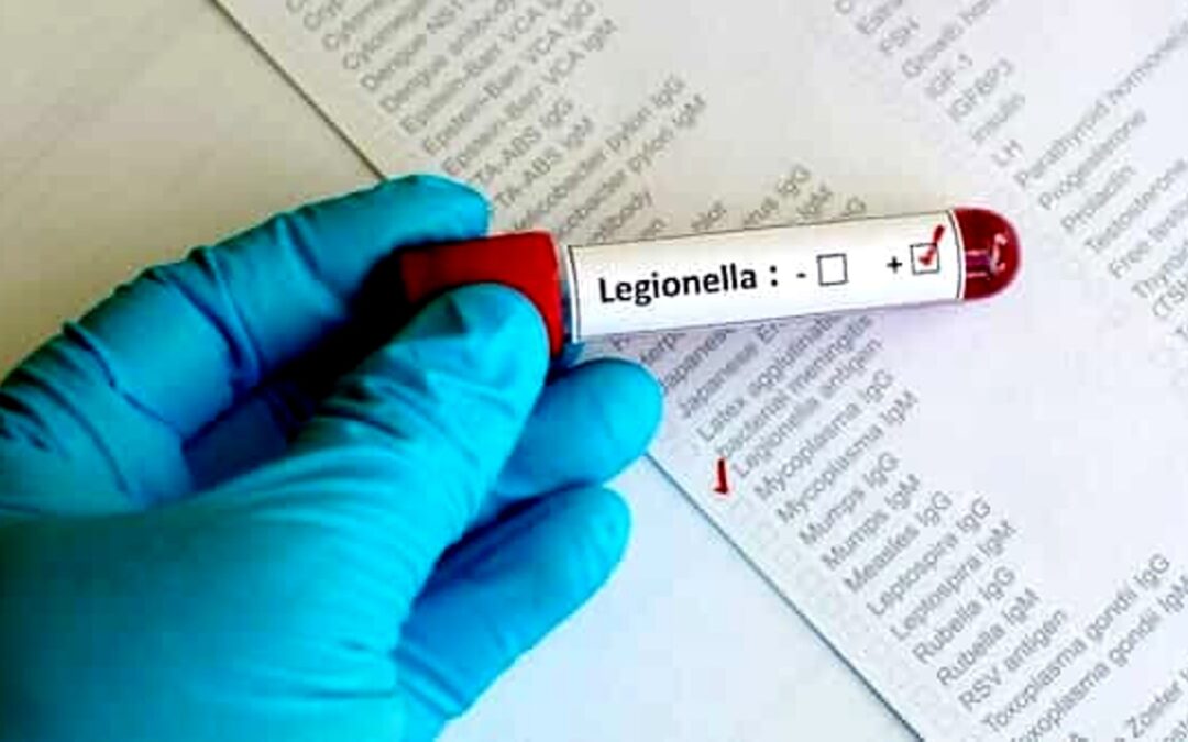 Legionella, analisi conformi: il Comune revoca l’ordinanza di sospensione per l’hotel di Latina | Latinatoday